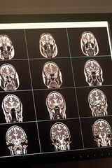 MRT images of a human