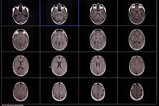 MRT images of a human brain