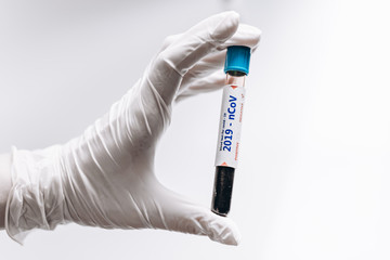 Obraz premium Negative blood test result for the new rapidly spreading Coronavirus.