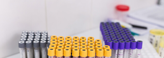 Many test tubes with blood being tested. Coronavirus and covid-19 concept.