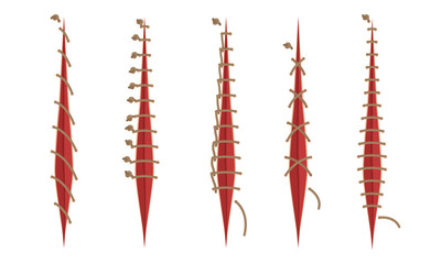 Different Surgical Stitches Isolated On White Background Vector Set