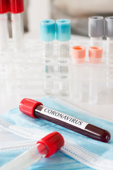 Coronavirus 2019-nCoV blood test with laboratory background
