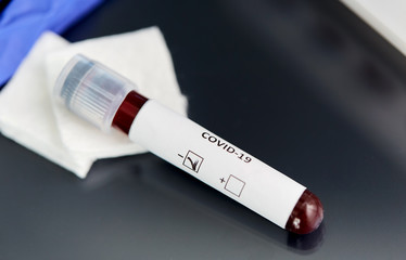 Fototapeta premium medicine, healthcare and pandemic concept - close up of beaker with negative coronavirus blood test on table at laboratory