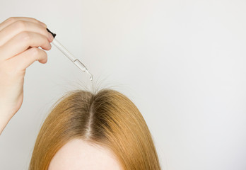A glass pipette with a hair growth agent is applied to the parting of the hair, red hair. New hair is growing. Hair care. Light background, free space for text.
