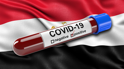 Obraz premium Flag of Egypt waving in the wind with a positive Covid-19 blood test tube. 3D illustration concept for blood testing for diagnosis of the new Corona virus.