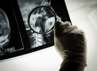 
Close-up of a doctor examining a human skull through a magnifier