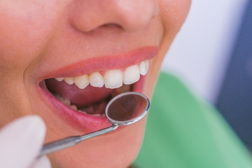 Closeup of a female patient with an open mouth during oral checkup at the dentist.