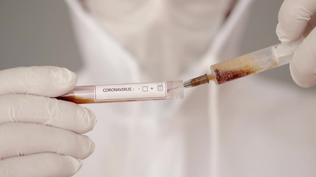 A male researcher is doing research in a laboratory. The scientist is wearing full-covering equipment as he deals with infectious liquid. The man is trying to fing the vaccine for coronairus. He is