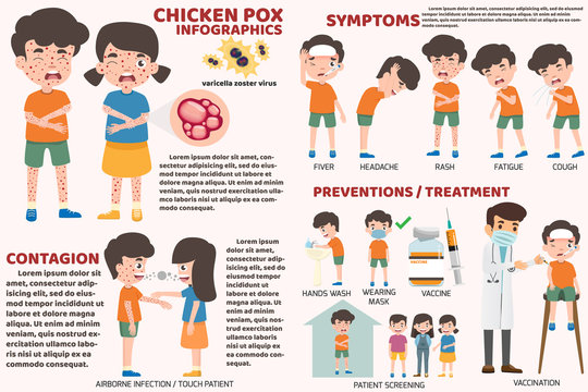 Children has chicken pox infographic, Poster children fever and chickenpox symptoms and prevention. Health care and medical  cartoon character vector illustration. Virus and bacteria sign elements.