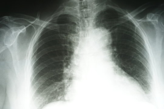 Medical concept: Image of adult x-ray film