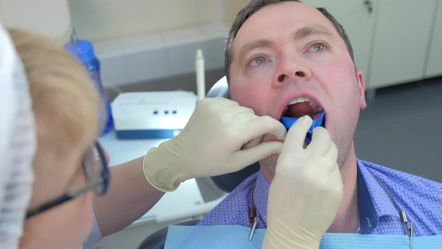 Dentist puts mouth guard with fluoride gel in man mouth in stomatology clinic. Procedure for fluoridation of teeth in dentistry. Stomatologist hygienists making fluorination teeth for patient.