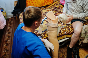 The prosthetist removes the measure from a person with a disability, man with amputee.