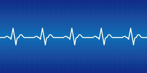 Graphic material representing an electrocardiogram