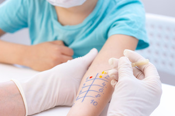 Allergen test on hand. child undergoing procedure of allergen skin test in clinic.