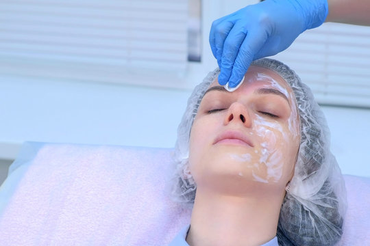 Beautician wiping cream with anesthetic cotton pads from girl face before biorevitalization in cosmetology. Cosmetologist preparing girl for mesotherapy procedure in beauty clinic, portrait closeup.