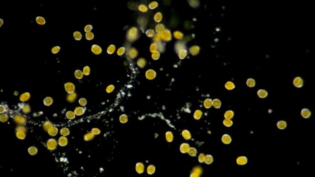 phytoplankton of the Black Sea, a colony of algae Dinoflagellata, or they are also called parasitic flagellates, mainly free-living photosynthetic organisms