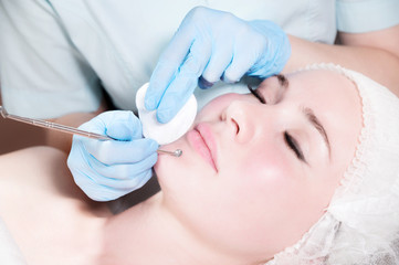 Close-up Mechanical face peel at the beautician. Beautician squeezes acne on the patient's forehead with a medical needle. Face next to hands in blue gloves of cosmologist