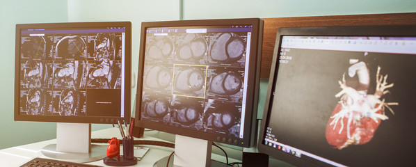 MRI CT Scanned image show on computer in DataCenter operation room.