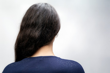 The woman is a brunette with her hair pulled back to one side, and her shoulders are bare, where dandruff is noticeable. Rear view. White background. The concept of dandruff and pediculosis