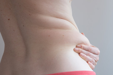 A woman holds a fold of excess fat at her waist. The concept of excess weight. Unhealthy diet.