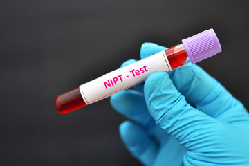 Blood sample tube for NIPT test or non-invasive prenatal testing, diagnosis for fetal Down syndrome...