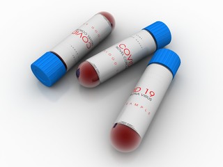 3D illustration covid 19 blood testing with sample bottle