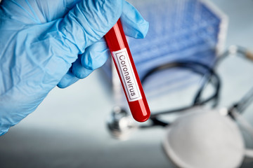 a nurse holding a vial of blood in a doctor's office with a Coronavirus label