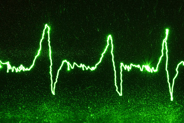 Green heartbeat on the black background, electrical cardiogram