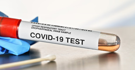 Obraz premium Coronavirus test concept - vial sample tube with cotton swab, blue gloves near, closeup detail. (Sticker is own design with dummy data, not real product)