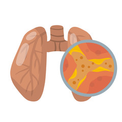 Lung disease. Blockage of canal. Mucus in alveoli. Breathing problems. Magnified view under microscope. Bronchi and bronchitis. Flat Educational medical material.