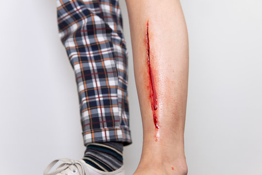 langer Cut am Schienbein mit Blut Stock Photo | Adobe Stock