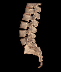 CT Lumbar or L-S spine 3D rendering image Front , back and Lateral view.