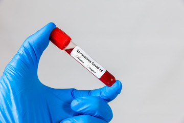 Doctor hand holding blood tube test.