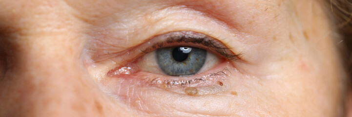 Close-up of aged and wrinkled half face of senior woman. Elderly lady looking at camera with calmness. Old lady with speaking look. Oldness and aging concept