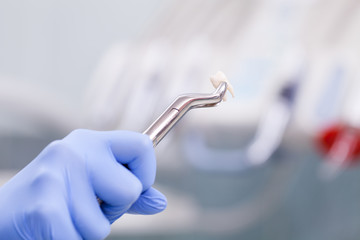 Tooth extraction