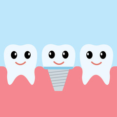 Row of health teeth with dental implant,healthcare concept,place for text