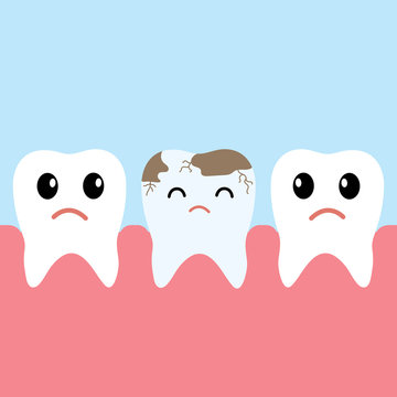 Row of health teeth and one bad tooth with caries,healthcare concept