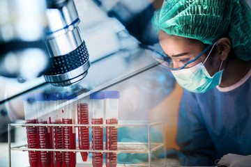 blood test tube sample of corona virus and microscope at laboratory with Team of doctors or surgeons in hospital surgery operating emergency room, Covid-19 and medical concept © totojang1977
