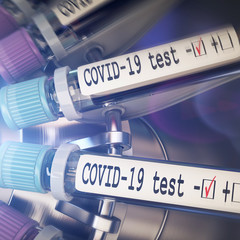 Negative COVID-19 test and laboratory sample of blood testing for diagnosis new Corona virus infection novel corona virus disease 2019 from Wuhan. Pandemic infectious concept 3D