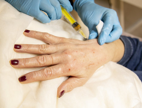 carrying out the procedure of plasmolifting on the hands of an elderly woman
procedure of rejuvenation and moisturizing of hands
