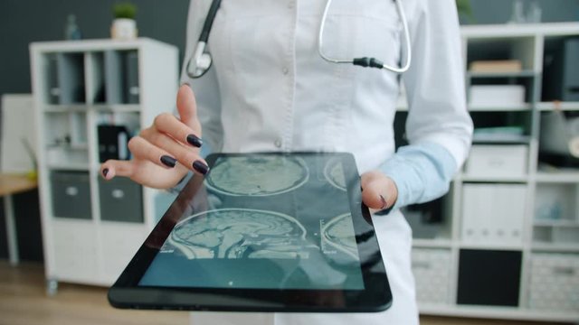 Close-up of female doctor's hand touching tablet screen checking MRI results of patient looking at images making diagnosis. Medicine, devices and modern technology concept.