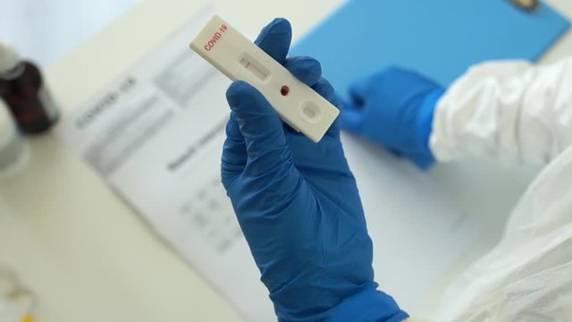 Doctor in laboratory holding a test kit for viral disease COVID-19 2019-nCoV. Lab card kit tested NEGATIVE for viral novel coronavirus sars-cov-2 virus