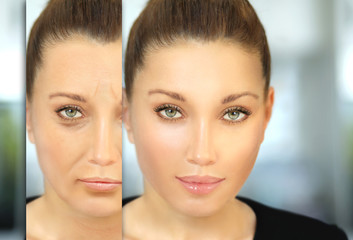 Aging. Mature woman-young woman.Face with skin problem.Showing photos before and after	