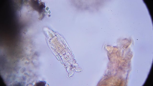 microscopic shrimp under the microscope