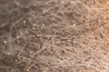 Backgrounds Colony Characteristics of Rhizopus (bread mold) is a genus of common saprophytic fungi, Rhizopus (bread mold) under the microscope.
