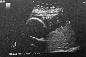 Ultrasound of baby in pregnant woman, Doctor reading test results of pregnant woman by ultrasound.
