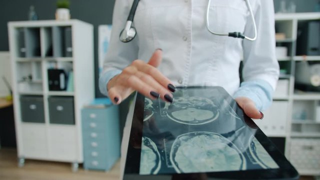 Close-up of woman's hand touching tablet screen with MRI images, doctor is working in office checking examination results. People and devices concept.