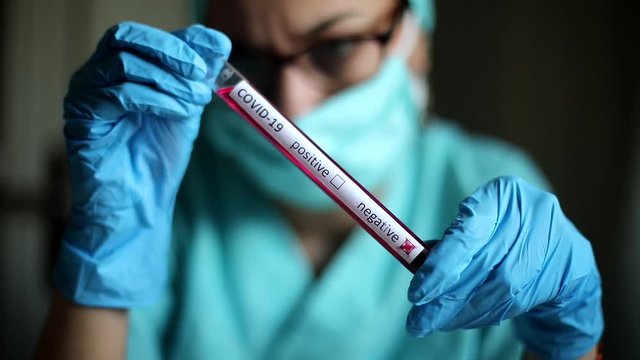 Conceptual video of a doctor's hands holding and looking at a test tube while with negative samples for the presence of coronavirus (COVID-19).