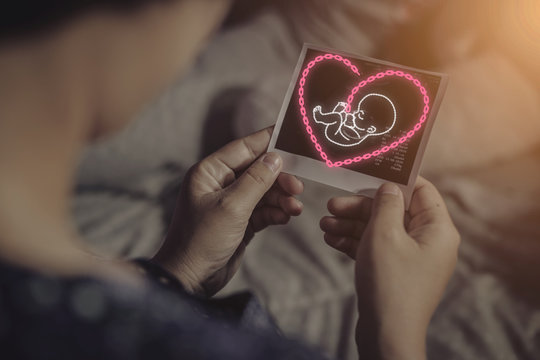 Mothers are looking at an ultrasound picture of a pregnant baby with a virtual baby icon, a chain icon concept that is arranged in a baby shape and has a heart shaped cord that shows care.