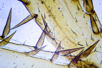 Microscopic image of cockroach leg
